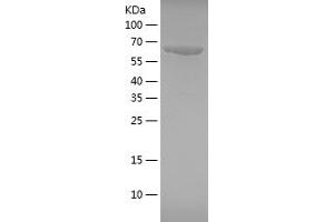 Western Blotting (WB) image for Heat Shock 70kDa Protein 1A (HSPA1A) (AA 291-641) protein (His-IF2DI Tag) (ABIN7123270)