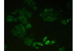 Detection of MCM2 in Human Hela Cells using Polyclonal Antibody to Minichromosome Maintenance Deficient 2 (MCM2)