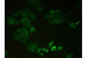 Detection of MCM2 in Human Hela Cells using Polyclonal Antibody to Minichromosome Maintenance Deficient 2 (MCM2) (Minichromosome Maintenance Deficient 2 (AA 473-679) anticorps)