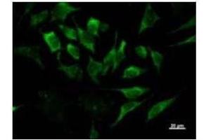 Immunostaining analysis in HeLa cells.