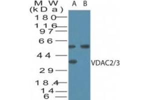 Image no. 1 for anti-Voltage-Dependent Anion Channel 2/3 (VDAC2/3) (AA 120-132) antibody (ABIN960406) (VDAC2/3 anticorps  (AA 120-132))