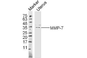 Mouse Uterus lysates probed with MMP-7 Polyclonal Antibody, unconjugated  at 1:300 overnight at 4°C followed by a conjugated secondary antibody at 1:10000 for 60 minutes at 37°C.