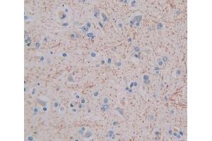 IHC-P analysis of brain tissue, with DAB staining. (GHRHR anticorps  (AA 23-130))