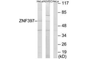 Western Blotting (WB) image for anti-Zinc Finger Protein 397 (ZNF397) (AA 10-59) antibody (ABIN2889680) (ZNF397 anticorps  (AA 10-59))