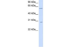 WB Suggested Anti-PNPLA4 Antibody Titration:  0.
