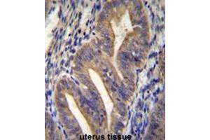 METTL10 Antibody (N-term) immunohistochemistry analysis in formalin fixed and paraffin embedded human uterus tissue followed by peroxidase conjugation of the secondary antibody and DAB staining. (METTL10 anticorps  (N-Term))