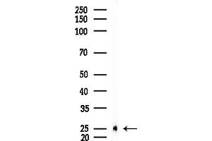 anti-Peroxiredoxin 2 (PRDX2) (C-Term) antibody
