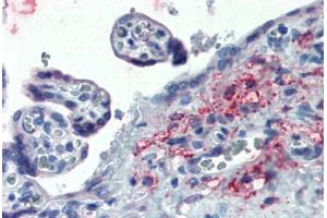 Placenta: Formalin-Fixed, Paraffin-Embedded (FFPE) (ERP44 anticorps  (Internal Region))