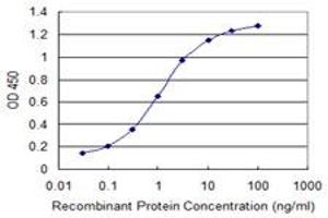 Detection limit for recombinant GST tagged MACF1 is 0.