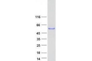 Validation with Western Blot