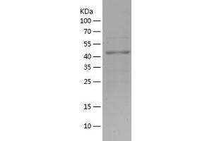 Western Blotting (WB) image for K(lysine) Acetyltransferase 2B (KAT2B) (AA 636-832) protein (His-IF2DI Tag) (ABIN7123657)