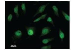 Immunostaining analysis in HeLa cells.