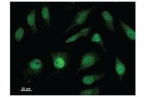 Immunostaining analysis in HeLa cells. (ISL2 anticorps)