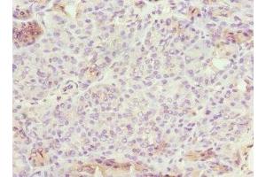 Immunohistochemistry of paraffin-embedded human pancreatic tissue using ABIN7151902 at dilution of 1:100 (EPS15L1 anticorps  (AA 585-864))