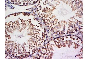 Paraformaldehyde-fixed, paraffin embedded mouse testis tissue, Antigen retrieval by boiling in sodium citrate buffer(pH6) for 15min, Block endogenous peroxidase by 3% hydrogen peroxide for 30 minutes, Blocking buffer (normal goat serum) at 37°C for 20min, Antibody incubation with Rabbit Anti-NEK9 Polyclonal Antibody, Unconjugated  at 1:500 overnight at 4°C, followed by a conjugated secondary and DAB staining