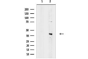 anti-Translocase of Inner Mitochondrial Membrane 50 Homolog (TIMM50) (C-Term) antibody