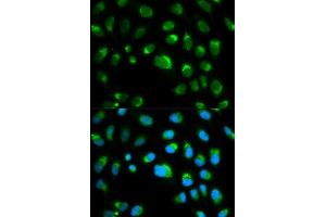 Immunofluorescence analysis of HeLa cell using TLR1 antibody. (TLR1 anticorps  (AA 30-290))