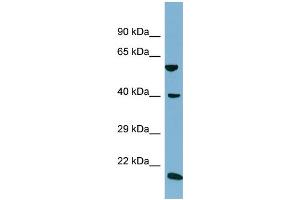 Host:  Rabbit  Target Name:  SLC2A10  Sample Type:  NCI-H226 Whole Cell lysates  Antibody Dilution:  1. (SLC2A10 anticorps  (C-Term))
