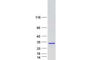 Cytochrome B Reductase 1 (CYBRD1) (Transcript Variant 1) protein (Myc-DYKDDDDK Tag)
