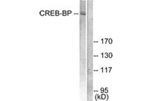 Western blot analysis of extracts from HeLa cells, treated with Insulin 0. (CBP anticorps  (AA 2393-2442))