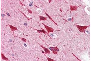 Human Brain, Cortex (formalin-fixed, paraffin-embedded) stained with GRB2 antibody ABIN364459 at 5 ug/ml followed by biotinylated anti-mouse IgG secondary antibody ABIN481714, alkaline phosphatase-streptavidin and chromogen.