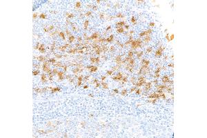 Immunohistochemistry (IHC) image for anti-Indoleamine 2,3-Dioxygenase 1 (IDO1) (AA 1-403) antibody (ABIN7449541) (Recombinant IDO1 anticorps  (AA 1-403))