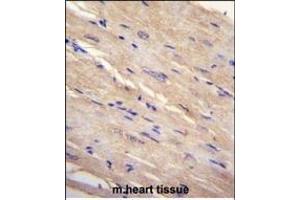 FB Antibody (N-term) (ABIN655226 and ABIN2844832) immunohistochemistry analysis in formalin fixed and paraffin embedded human m. (FAM69B anticorps  (N-Term))