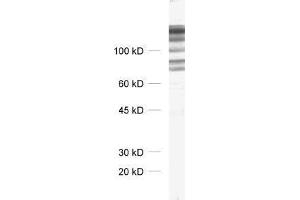dilution: 1 : 1000, sample: crude synaptosomal fraction of rat brain (P2) (DLG1 anticorps)