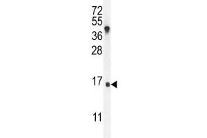 IGKV antibody western blot analysis in MDA-MB435 lysate. (IGKV A18 anticorps  (AA 80-107))
