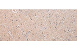 Immunohistochemistry of paraffin-embedded Human brain tissue using DEFB112 Polyclonal Antibody at dilution of 1:40(x200) (DEFB112 anticorps)