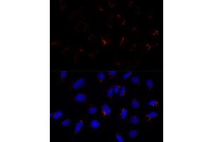 Immunofluorescence analysis of U-2 OS cells using ETHE1 Polyclonal Antibody (ABIN6131616, ABIN6140319, ABIN6140320 and ABIN6214289) at dilution of 1:100 (40x lens).