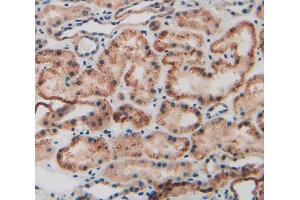 Used in DAB staining on fromalin fixed paraffin- embedded kidney tissue (KRT9 anticorps  (AA 315-456))