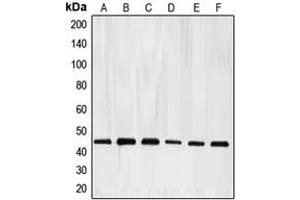 Western blot analysis of E2F4 expression in HeLa (A), K562 (B), Jurkat (C), Raji (D), A431 (E), mouse kidney (F) whole cell lysates. (E2F4 anticorps  (Center))