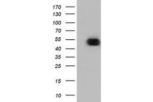 Western Blotting (WB) image for anti-Ornithine Decarboxylase 1 (ODC1) antibody (ABIN1499910)
