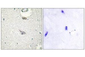 Immunohistochemistry (IHC) image for anti-Cell Adhesion Molecule 4 (CADM4) (C-Term) antibody (ABIN1850236) (Cell Adhesion Molecule 4 anticorps  (C-Term))