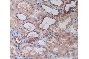 IHC-P analysis of kidney tissue, with DAB staining. (SLC12A3 anticorps  (AA 3-146))