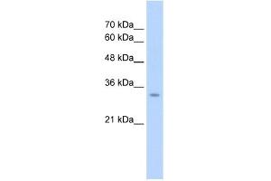 WB Suggested Antibody Titration:  2. (GLS2 anticorps  (Middle Region))