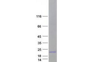Validation with Western Blot