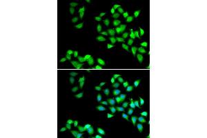 Immunofluorescence analysis of HeLa cell using NNMT antibody. (NNMT anticorps)