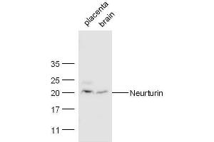 Mouse placenta and heart lysates probed with Rabbit Anti-Neurturin Polyclonal Antibody, Unconjugated  at 1:500 for 90 min at 37˚C. (Neurturin anticorps  (AA 151-197))