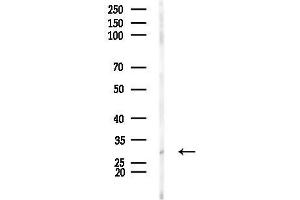 Western blot analysis of lysates from Mouse muscle, using CITE Antibody at 1/1000 dilution.