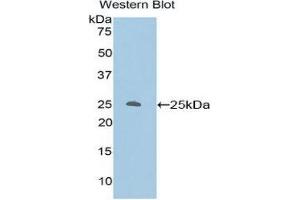 Western Blotting (WB) image for anti-Protein Kinase C, zeta (PRKCZ) (AA 404-591) antibody (ABIN3206748) (PKC zeta anticorps  (AA 404-591))