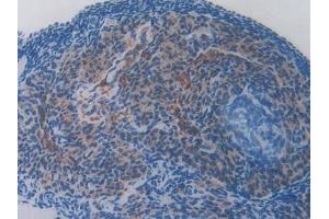 Detection of FTMT in Mouse Ovary Tissue using Polyclonal Antibody to Ferritin, Mitochondrial (FTMT)