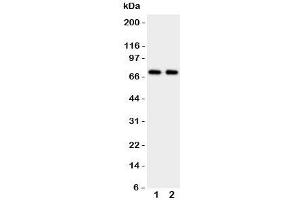 Western blot testing of Prolactin Receptor antibody and Lane 1:  HeLa;  2: MCF-7 cell lysate