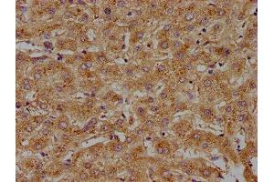IHC image of ABIN7143238 diluted at 1:100 and staining in paraffin-embedded human liver tissue performed on a Leica BondTM system. (ACOT8 anticorps  (AA 1-200))