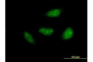 Immunofluorescence of purified MaxPab antibody to NOL6 on HeLa cell.