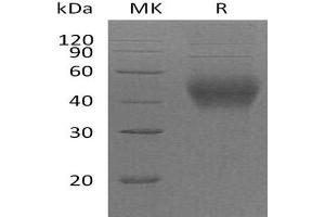 Western Blotting (WB) image for CD48 (CD48) protein (His tag) (ABIN7320721) (CD48 Protein (CD48) (His tag))