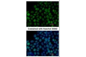 ICC/IF Image Immunofluorescence analysis of paraformaldehyde-fixed mouse ESC, using SOX2, antibody at 1:200 dilution. (SOX2 anticorps)