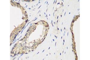 Immunohistochemistry of paraffin-embedded Human prostate using METTL7A Polyclonal Antibody at dilution of 1:200 (40x lens).