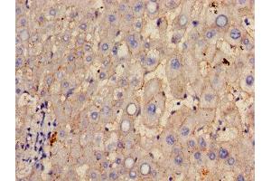 Immunohistochemistry of paraffin-embedded human liver tissue using ABIN7154060 at dilution of 1:100 (GGT1 anticorps  (AA 13-225))